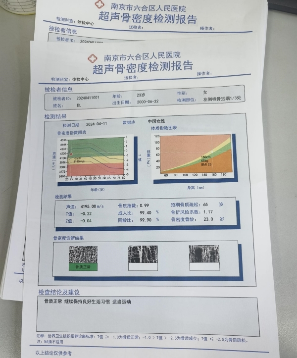 一文了解超聲骨密度儀的基本原理、技術特點及應用領域